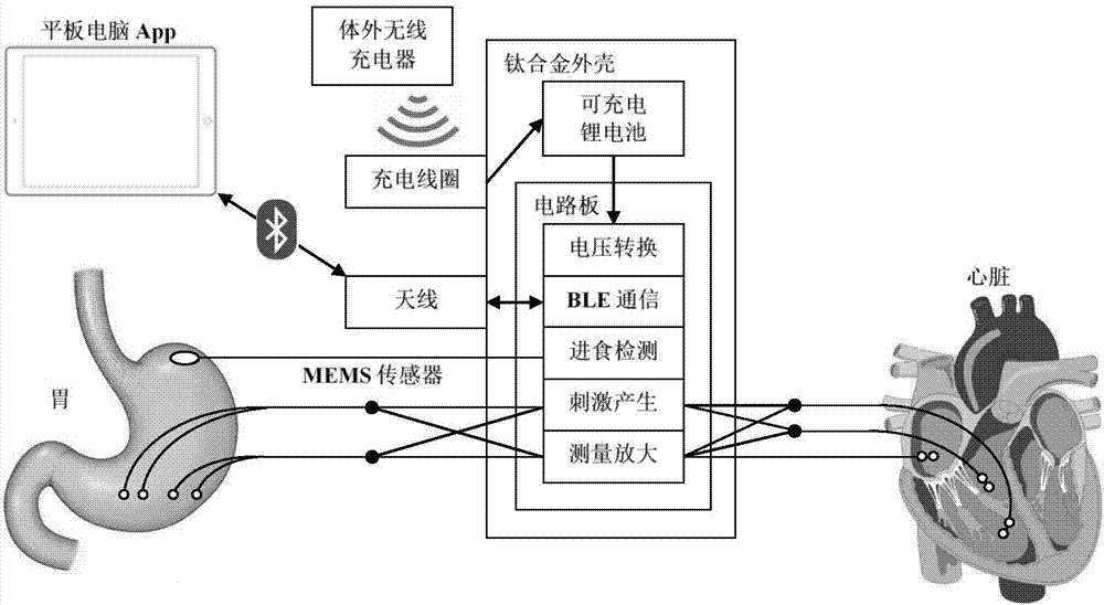 帶有充電功能的電刺激器系統(tǒng)的制作方法與工藝