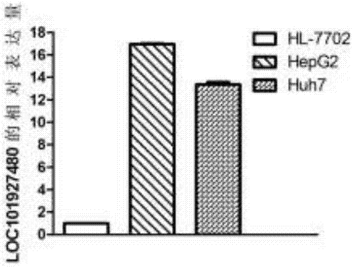 lncRNA作为生物标志物在肝癌诊疗中的用途的制作方法与工艺