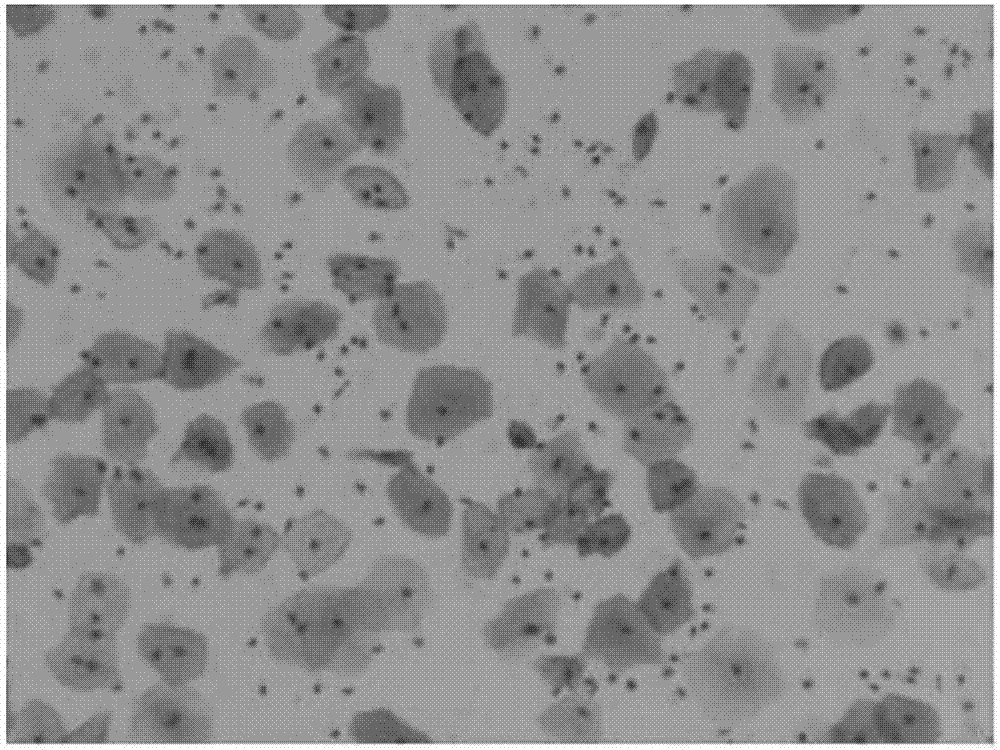 一种用于液基薄层细胞的免疫p16ink4a抗原保存液及其