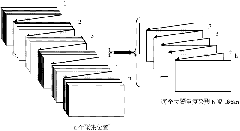 一种超声微血管血流成像方法与流程