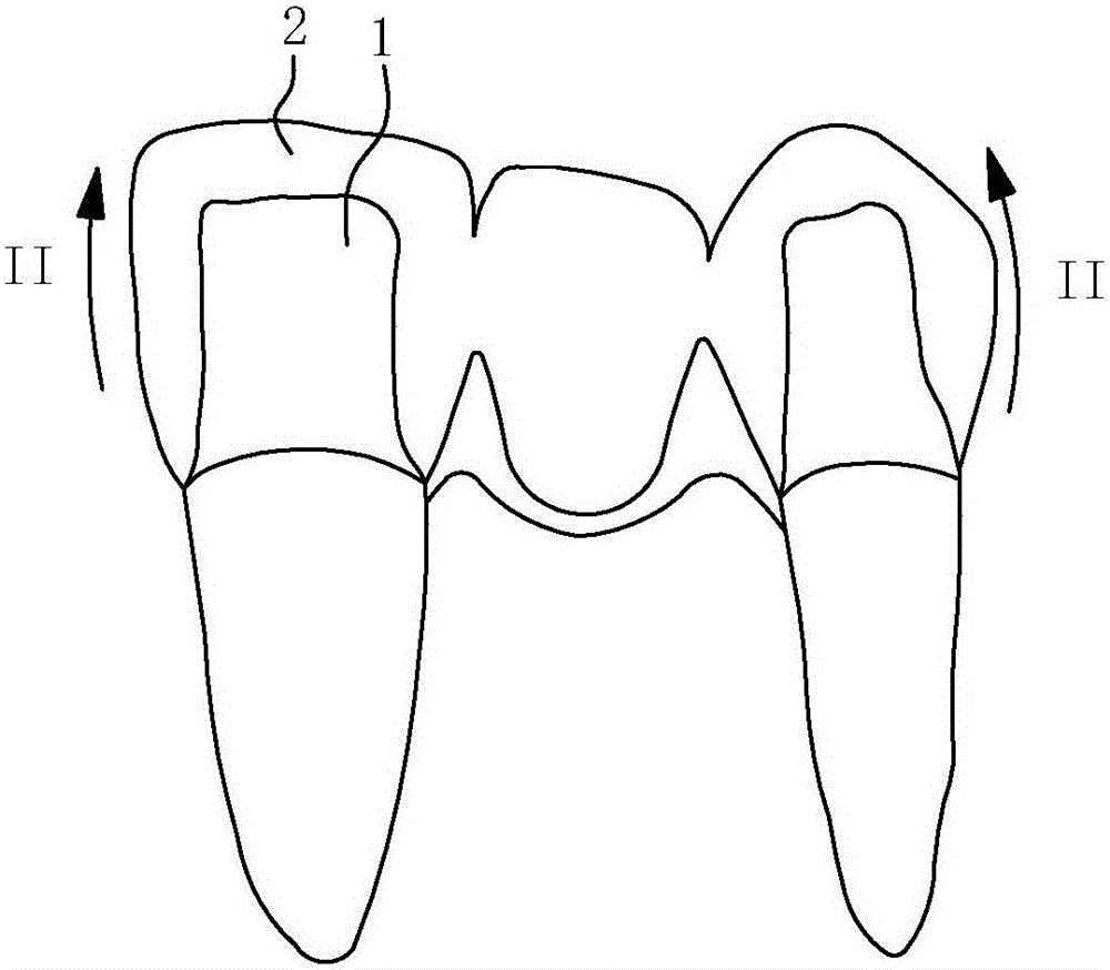 一种全氧化锆仿真义齿制造方法与流程