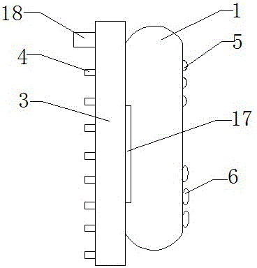 一种体内定位防返流球囊的制作方法与工艺