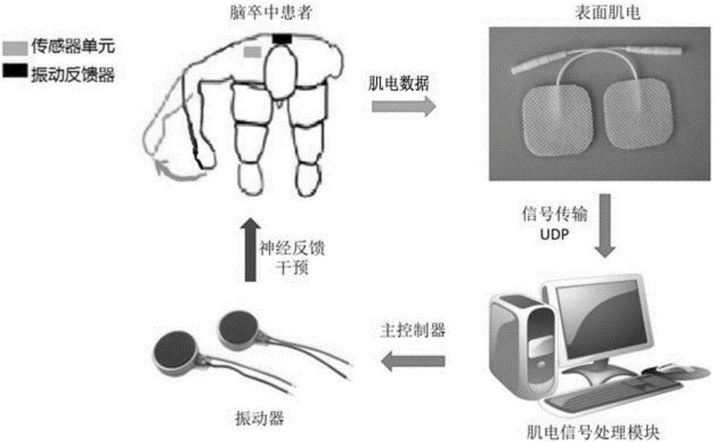 一种基于表面肌电的神经反馈康复干预系统及方法与流程