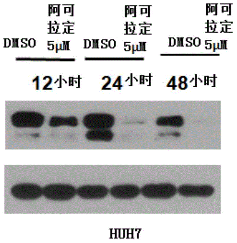 阿可拉定在制備用于治療GP130相關(guān)疾病藥物中的用途的制作方法與工藝