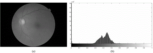 一种基于LAB颜色空间的彩色眼底图像增强方法与流程
