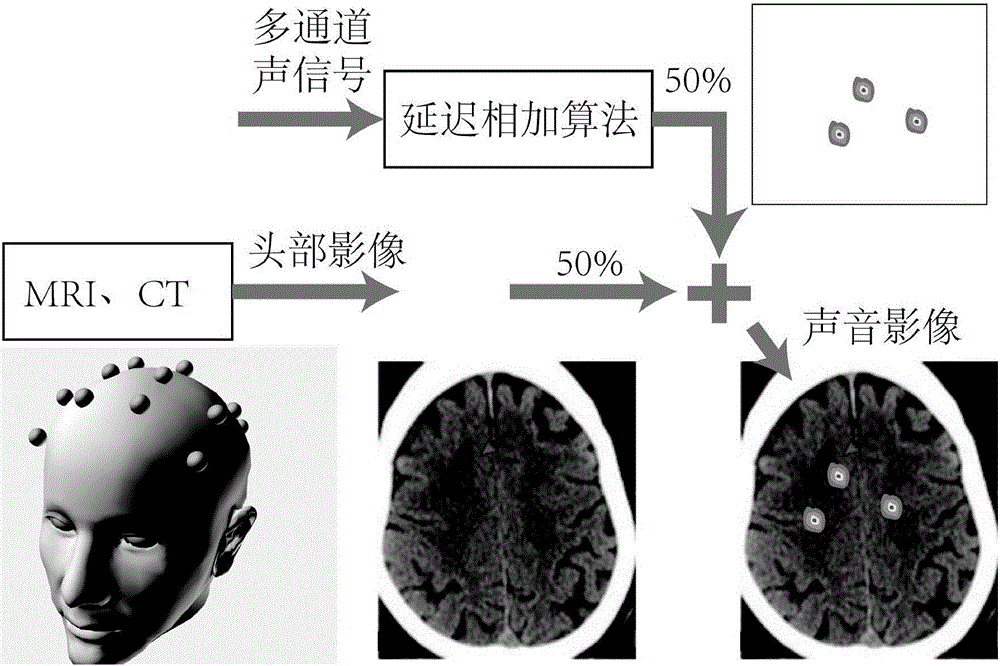 结合磁声耦合和声源定位技术的无创生物脑电测量方法与流程