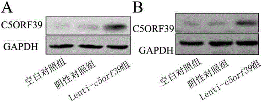 一種過(guò)表達(dá)c5orf39基因質(zhì)粒構(gòu)建方法及其在新生血管形成中的應(yīng)用與流程