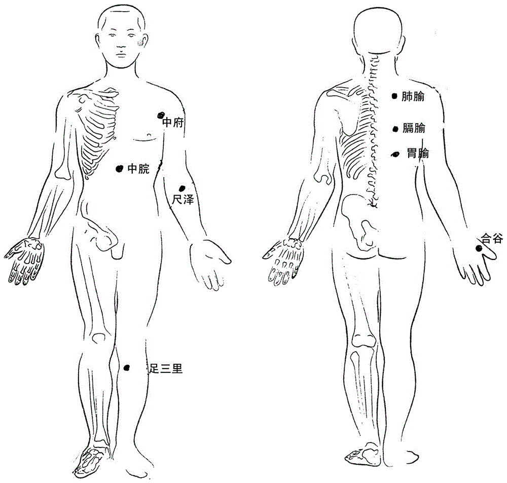 一种灸疗痤疮的药艾灸的制作方法与工艺