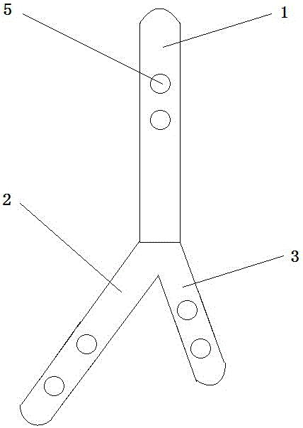 用于治療足踝部多發(fā)關(guān)節(jié)炎的四關(guān)節(jié)融合鎖定接骨板的制作方法與工藝