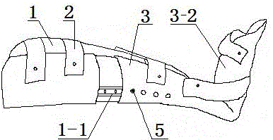 伸縮式下肢外固定支具的制作方法與工藝