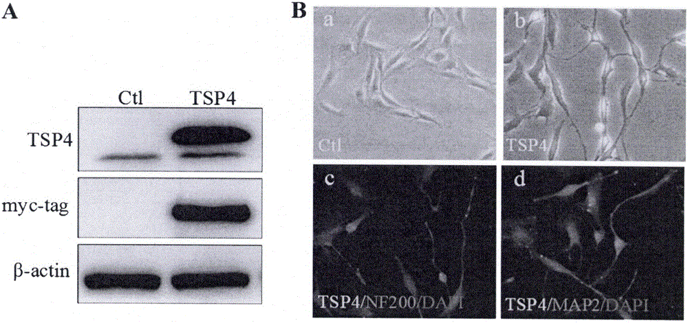 一种TSP4促进NG2细胞分化为神经细胞的实验方法与流程