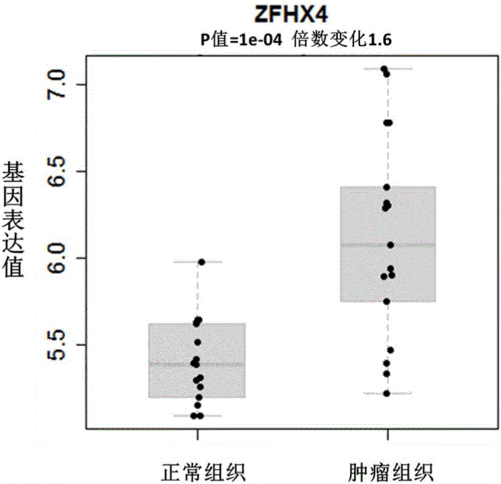 ZFHX4作为食管癌预后诊断的生物标志物的制作方法与工艺