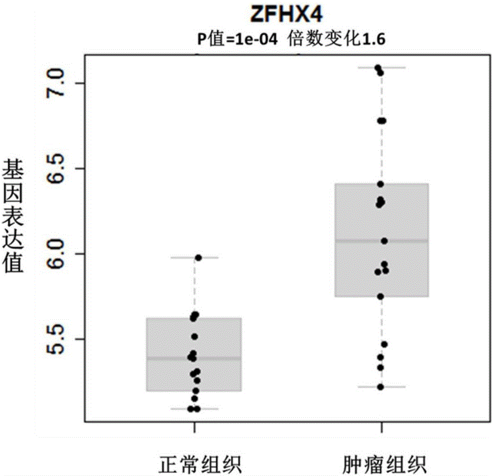 ZFHX4作為食管癌預(yù)后診斷的生物標(biāo)志物的制作方法與工藝