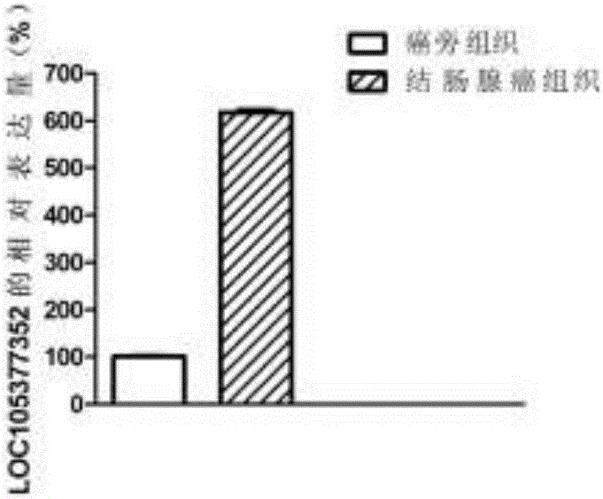 一種用于結(jié)腸腺癌的分子標(biāo)志物的制作方法與工藝