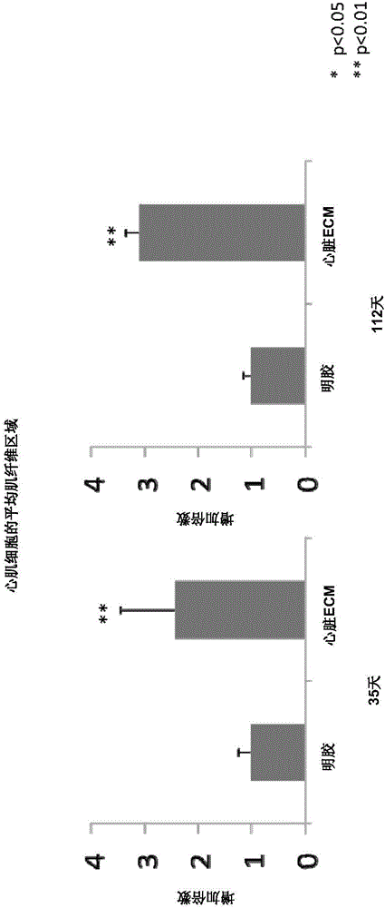 用于組織修復(fù)的使用細(xì)胞外基質(zhì)的組合物和方法與流程