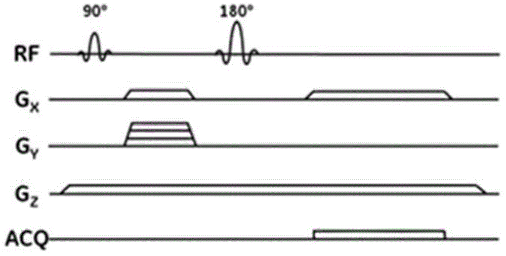 磁共振成像系统及方法与流程