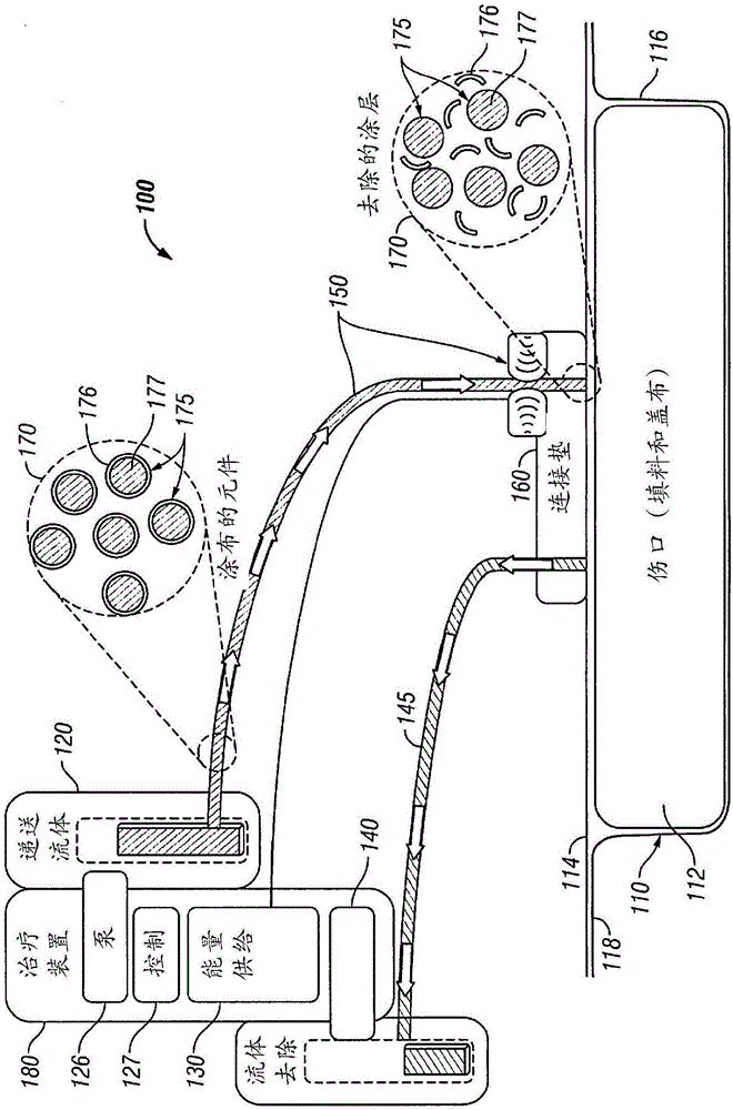 用于滴注疗法使用的流体的刺激和激活的系统和方法与流程