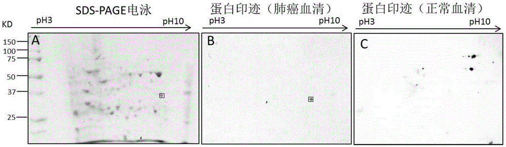 一種ECH1自身抗體的篩選和鑒定方法及其應(yīng)用與流程