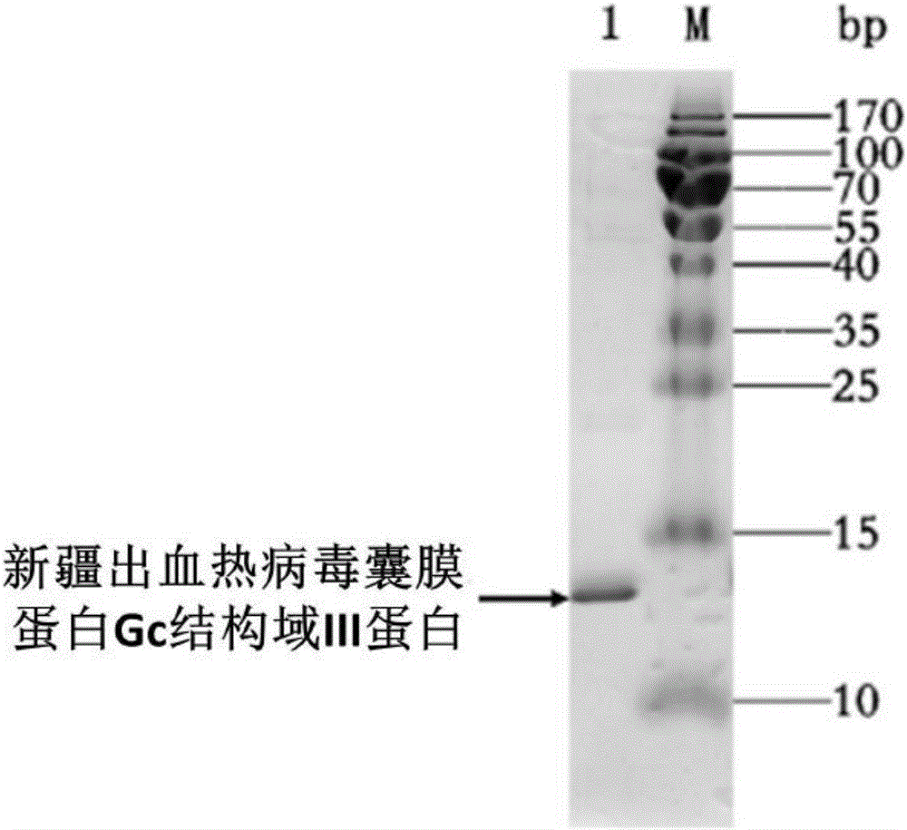 一種中和新疆出血熱病毒的單域抗體的制作方法與工藝