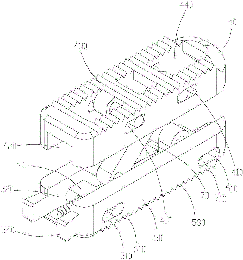 椎体融合器的制作方法与工艺