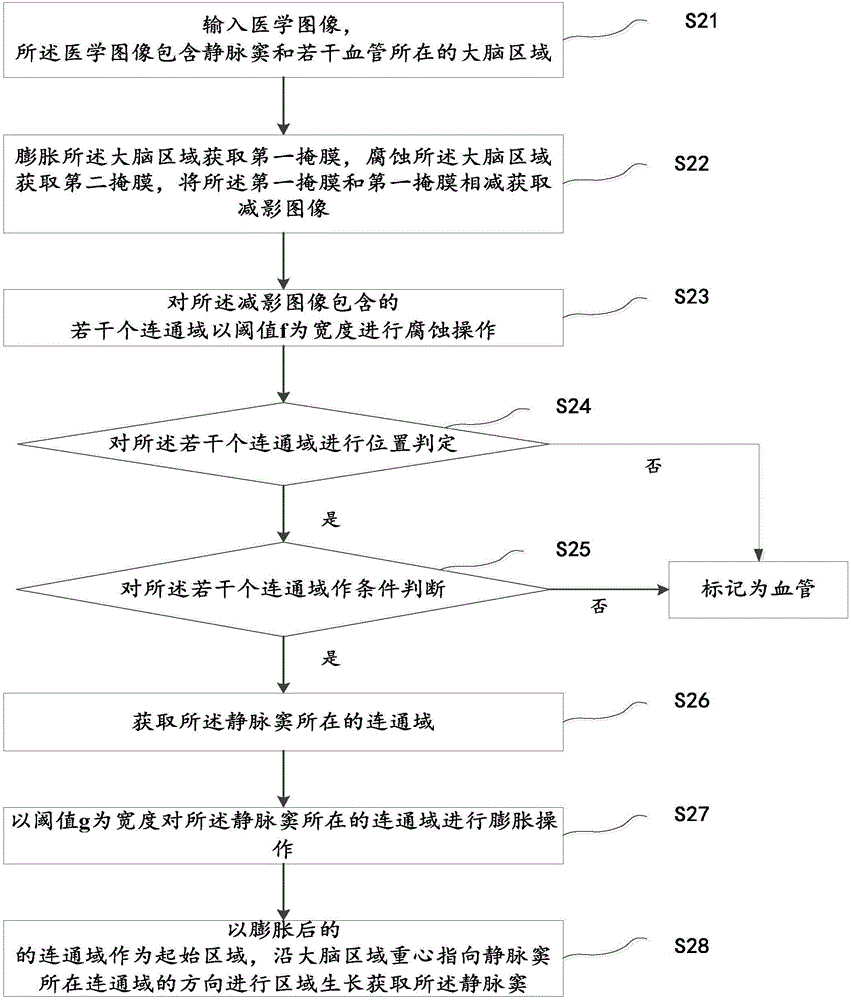 靜脈竇的分割方法與流程