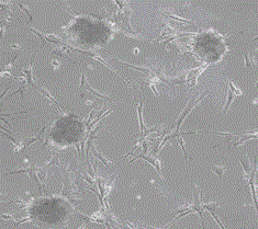 干细胞小球诱导培养液及干细胞小球培养方法与流程