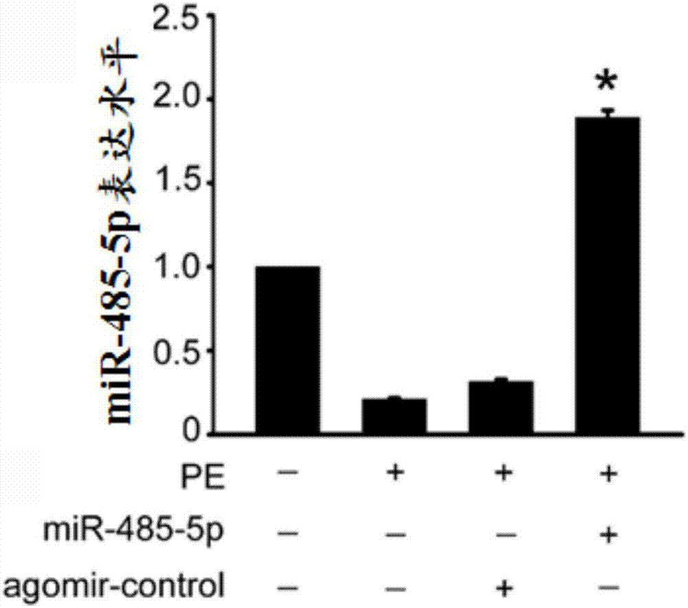 miRNA?485?5p核苷酸類似物及其反義核苷酸的應(yīng)用和應(yīng)用其的產(chǎn)品的制作方法與工藝