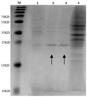制备重组红鳍东方鲀IFN‑γ蛋白的基因及方法与流程