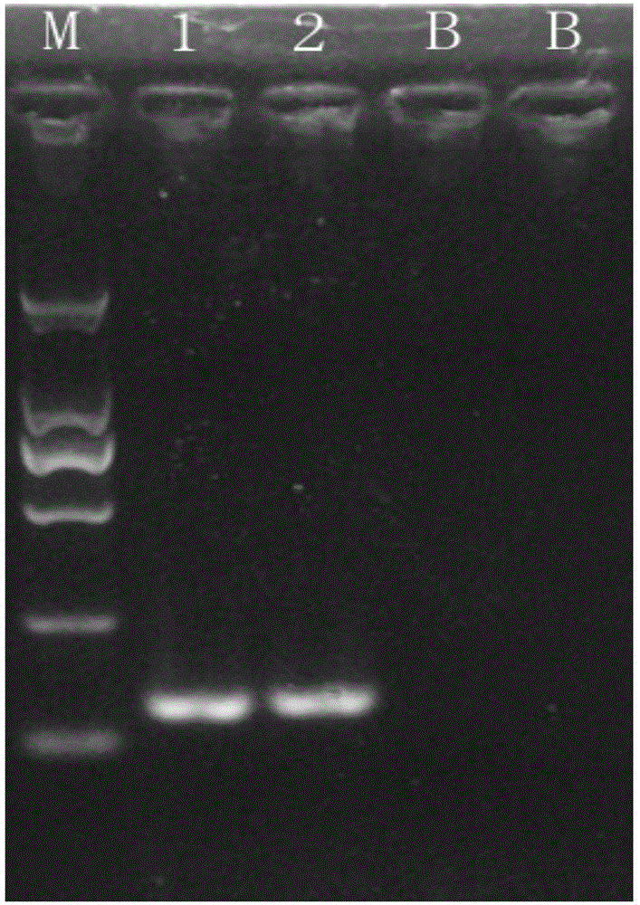 大肠杆菌O111和大肠杆菌O157的检测引物组、试剂盒及双重PCR检测方法与流程