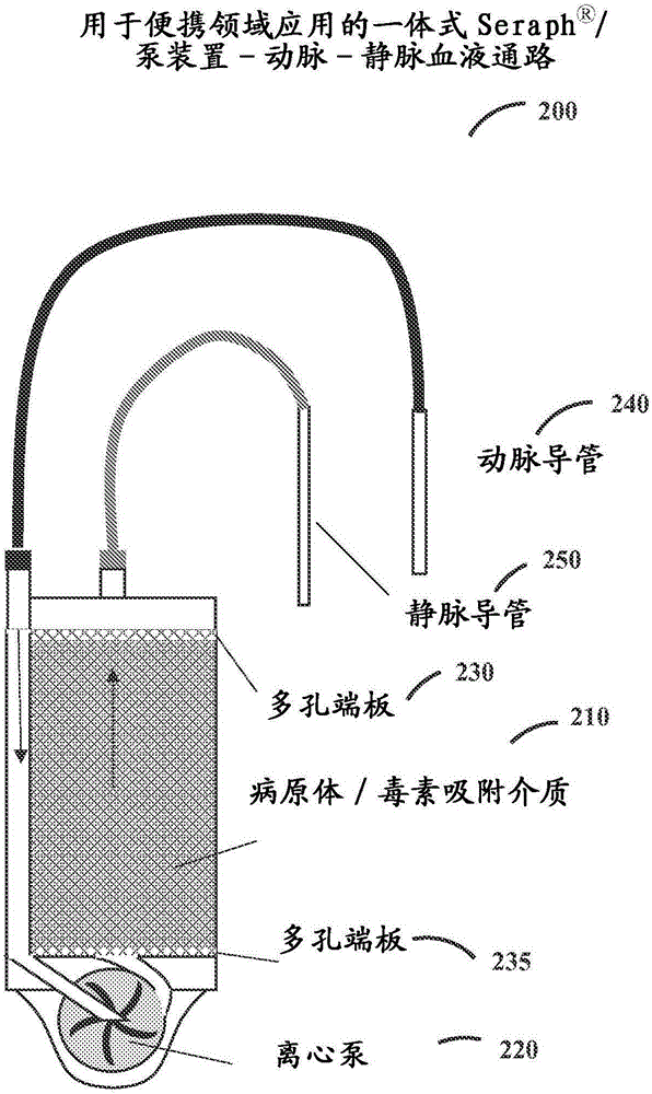 可穿戴的血液灌流裝置的制作方法