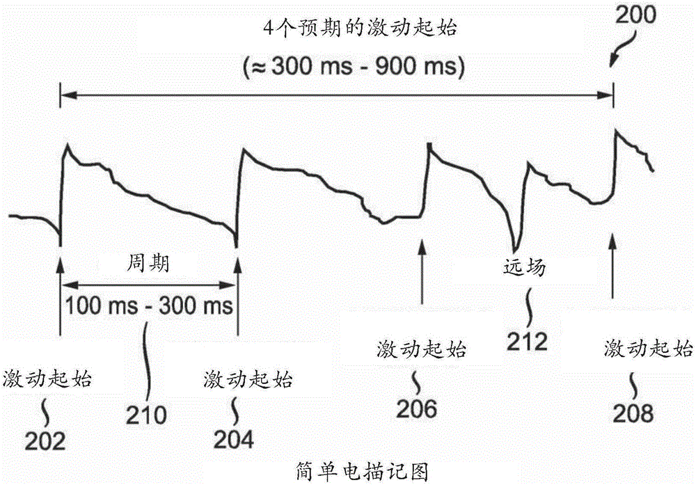 用于重建心脏激动信息的系统和方法与流程