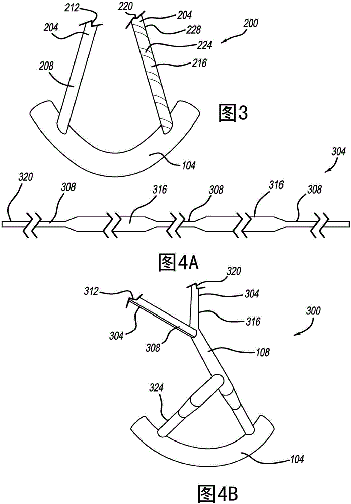 防滑的軟錨固件的制作方法與工藝