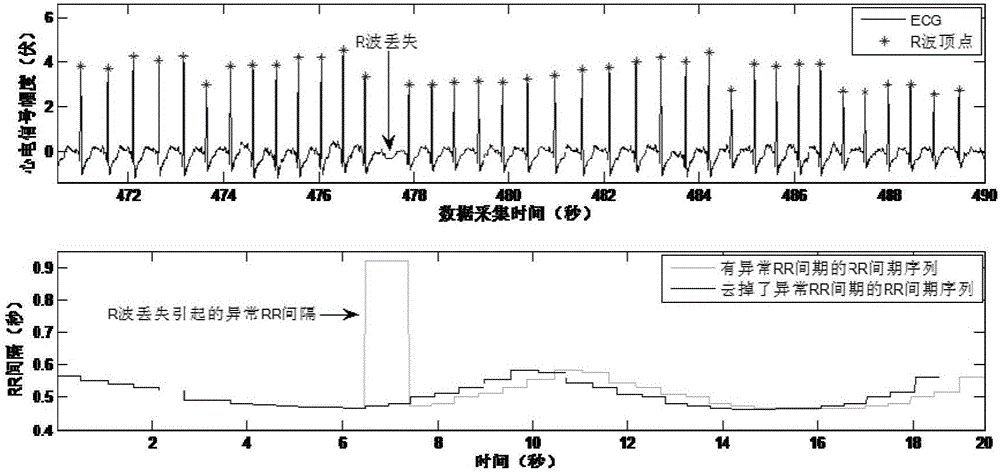 一種用心率測(cè)度實(shí)時(shí)檢測(cè)說(shuō)話(huà)期間心理應(yīng)激狀態(tài)的方法與流程