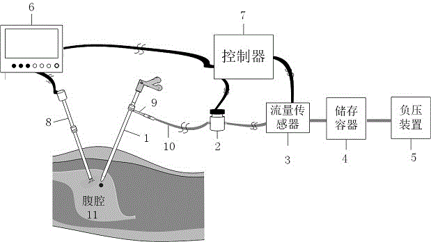 外科手術(shù)智能排煙系統(tǒng)和方法與流程