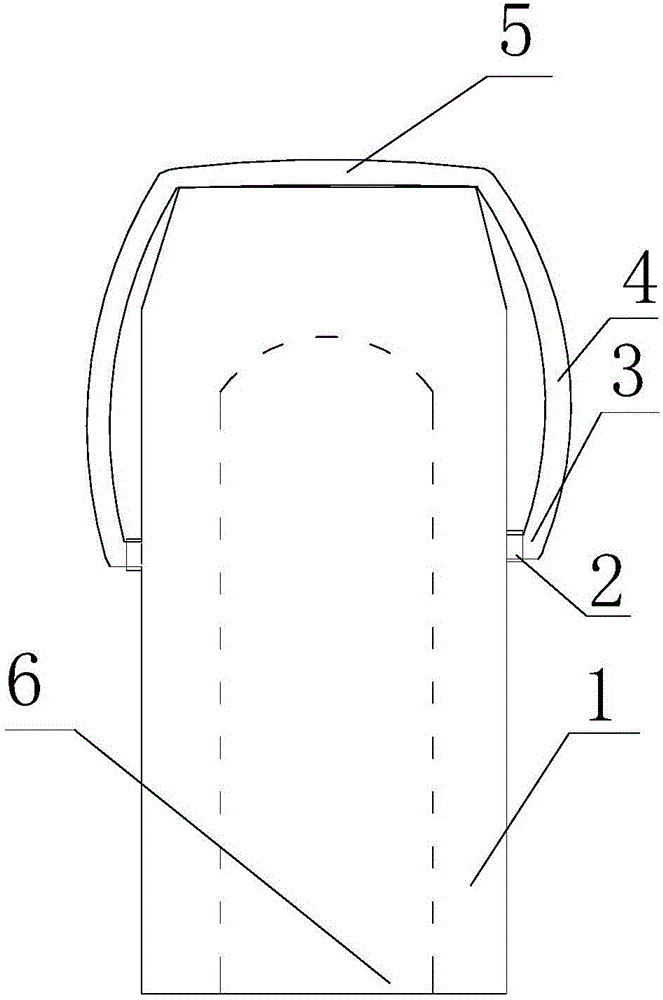 一种手指矫正器的制作方法与工艺