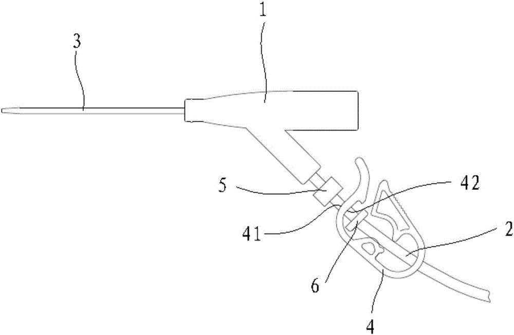 防血栓留置針的制作方法與工藝