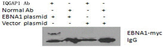 siRNA?IQGAP1及其在制備EBV相關(guān)性腫瘤藥物中的用途的制作方法與工藝