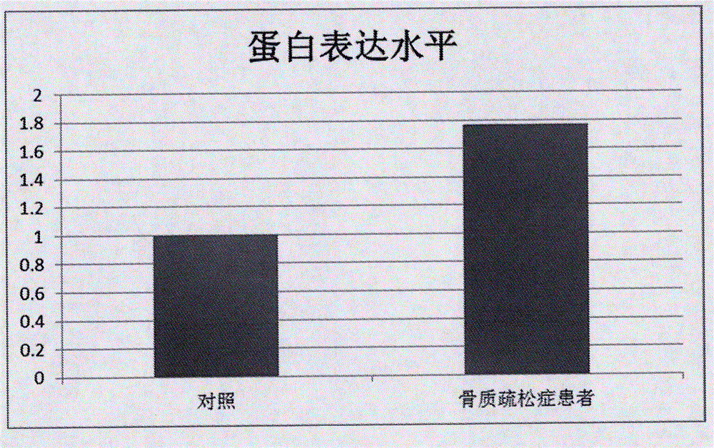 ZNF800基因在制備骨質(zhì)疏松癥早期篩查產(chǎn)品中的應(yīng)用的制作方法與工藝