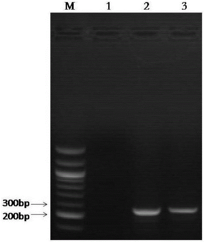 一种检测人巨噬细胞钙激活钾通道核酸的荧光定量PCR引物、探针及试剂盒的制作方法与工艺