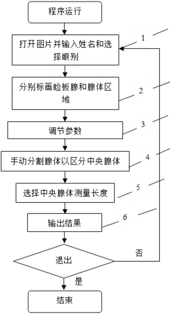 一种对睑板腺图像进行处理以获得腺体参数的信息的方法与流程