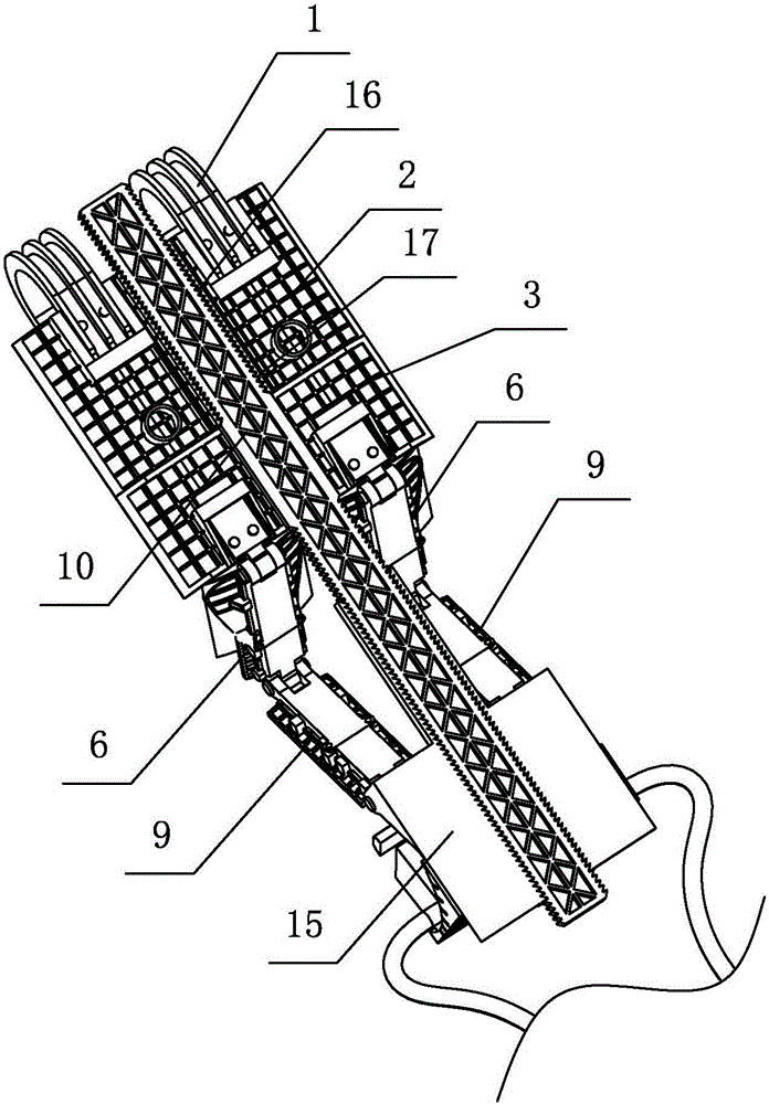 一种脊柱关节负重位医学影像检查的辅助装置的制作方法