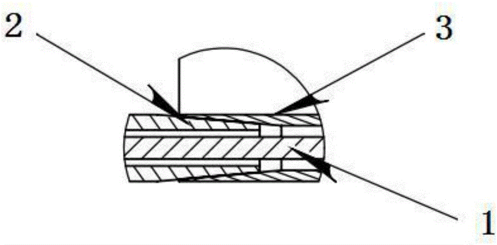 具有牵引推送功能的施莱姆氏管支架的制作方法与工艺
