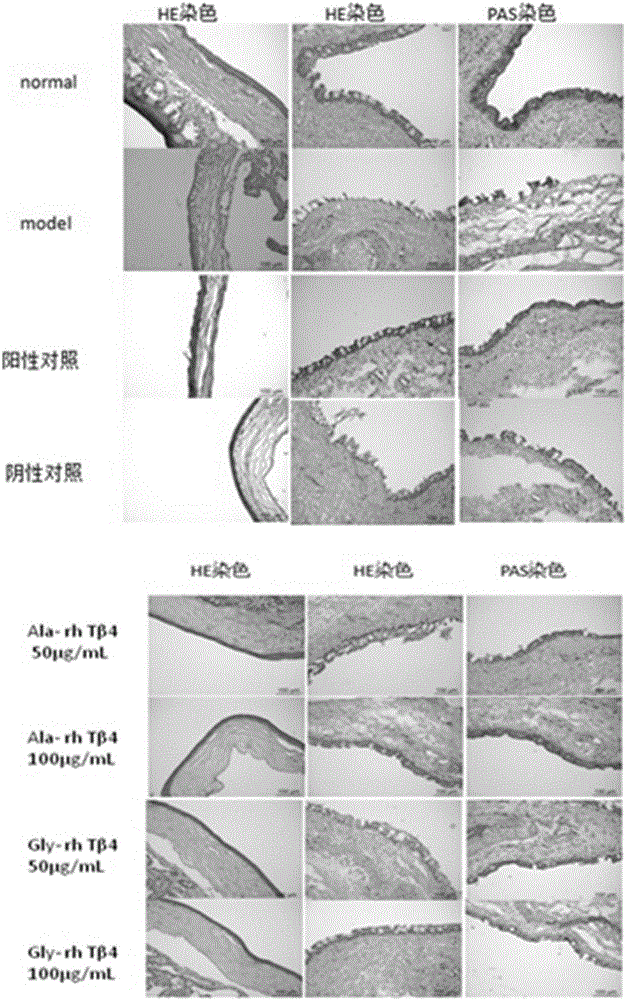 一種用于治療眼部疾病的藥物及其組合物的制作方法與工藝