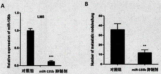 miR?135b抑制劑在治療骨肉瘤肺轉(zhuǎn)移和復(fù)發(fā)的藥物中的用途的制作方法與工藝