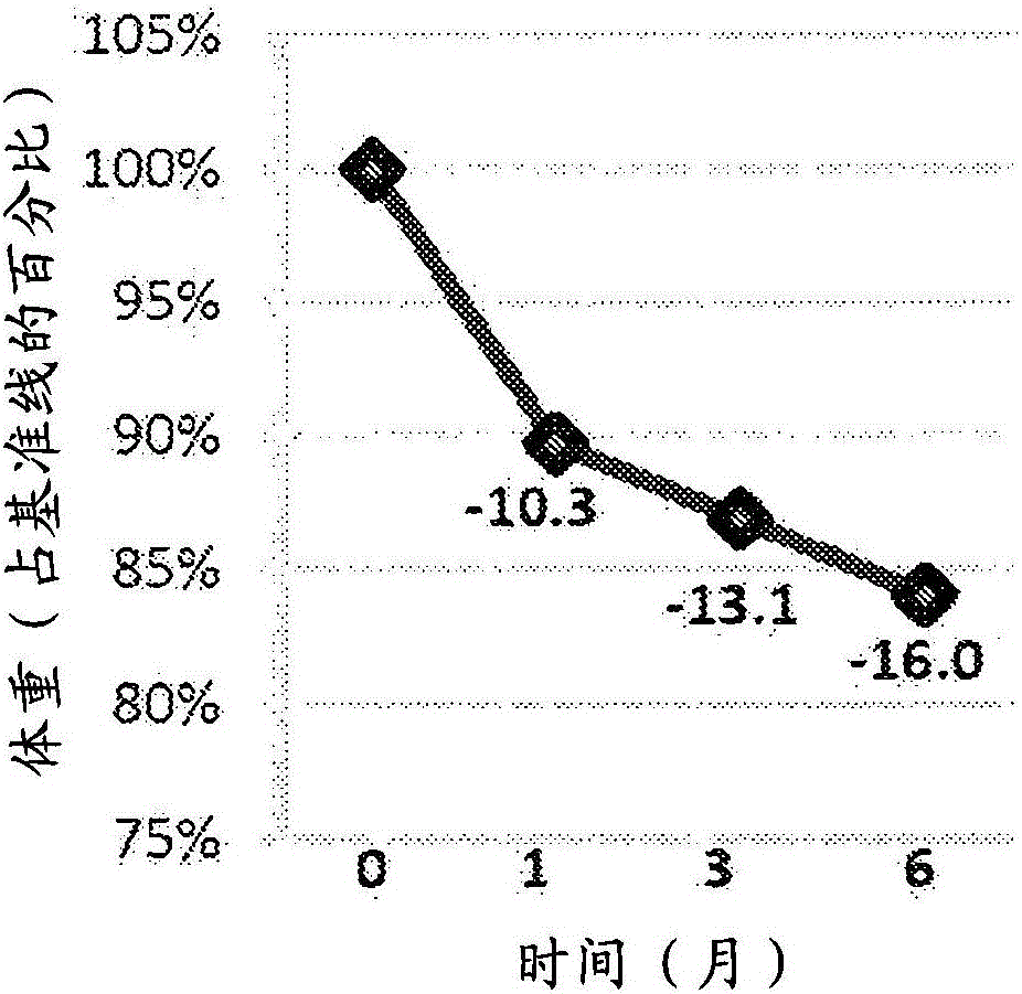 將顆粒物選擇性地輸送到左胃動脈的遠(yuǎn)側(cè)部分中的制作方法與工藝