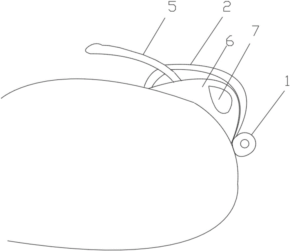 经会阴前列腺穿刺保护套的制作方法与工艺