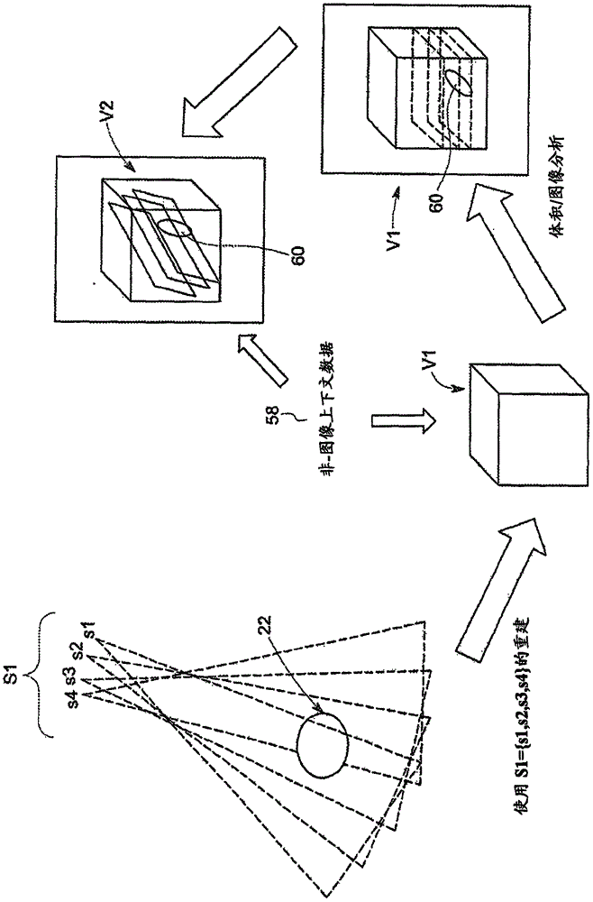 迭代X‑射线成像最优化方法和系统与流程