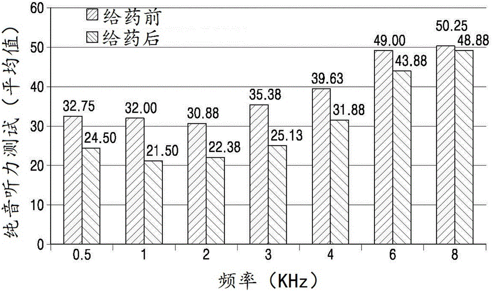 預(yù)防或治療感音神經(jīng)性耳聾或耳鳴的包括富含血小板的血漿的藥物組合物及其使用方法與流程