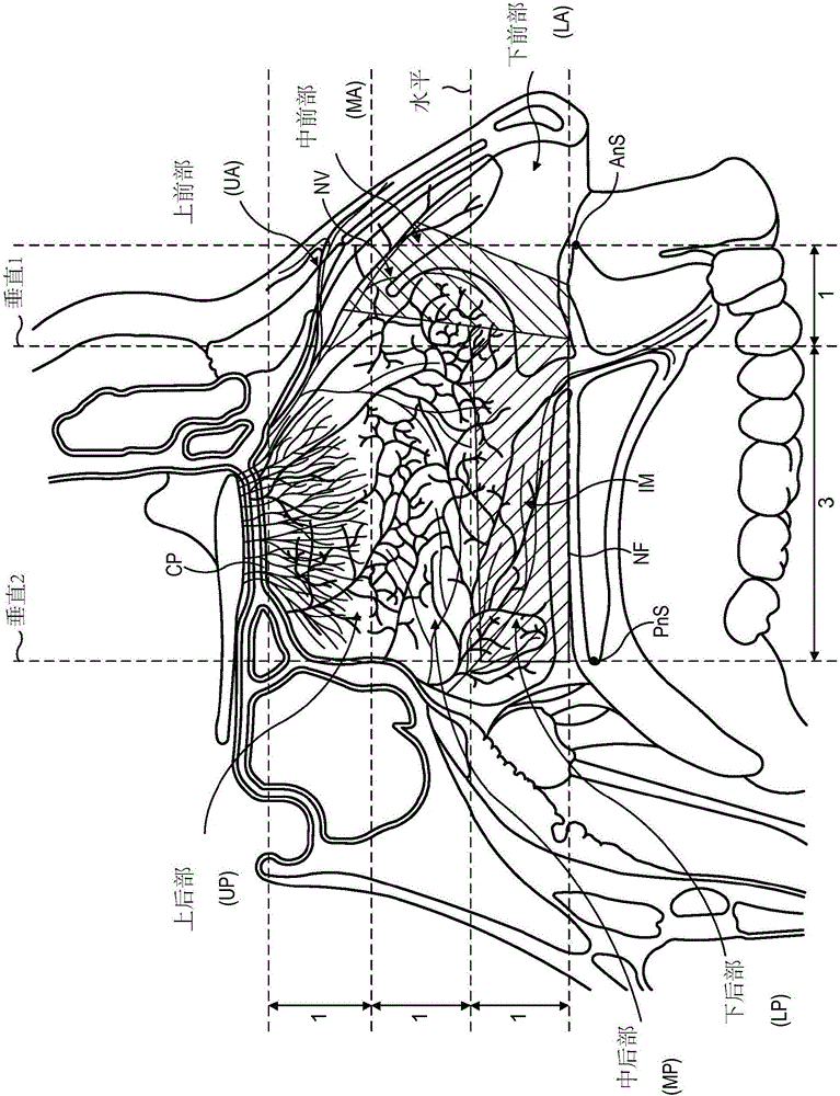 鼻腔給藥的制作方法與工藝