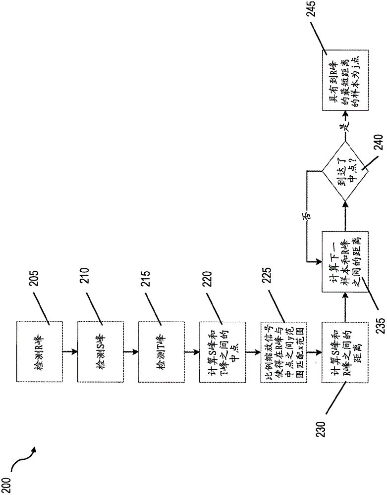 定位心電圖信號中的J點的制作方法與工藝